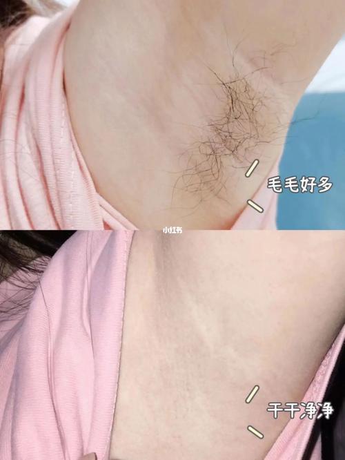 妈妈美白蚌埠是私人的吗成网络热点