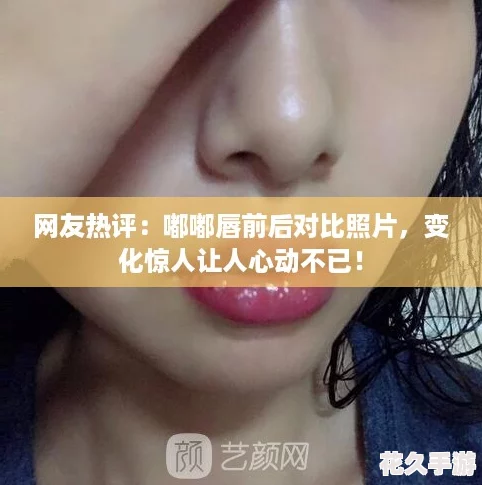 友热评：嘟嘟唇前后对比照片-变化惊人让人心动不已！