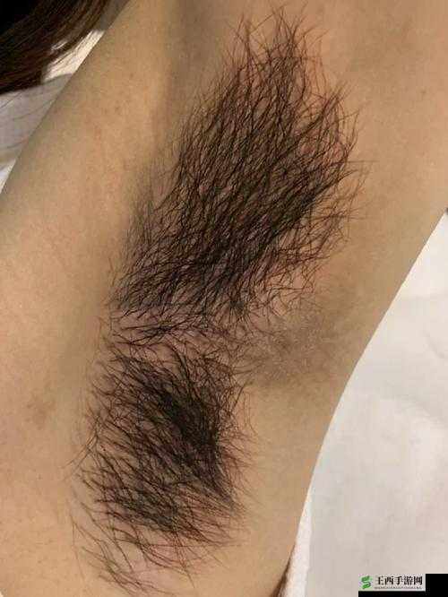 中国妇女裸体毛毛多：性与美之间的争议