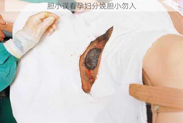胆小误看孕妇分娩胆小勿入